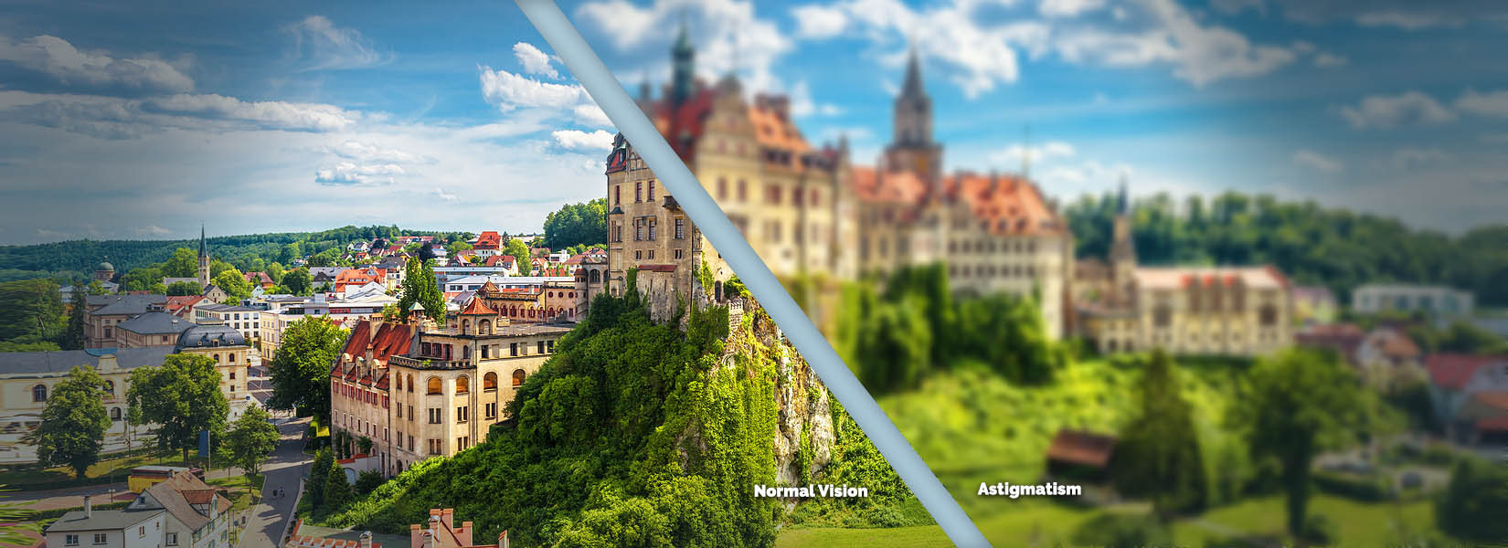 Astigmatism Treatment in Cleburne