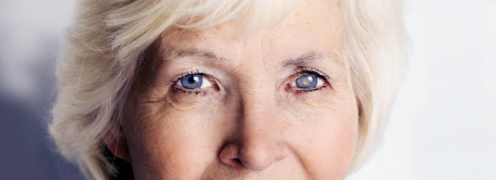 Cataract Surgery in Cleburne